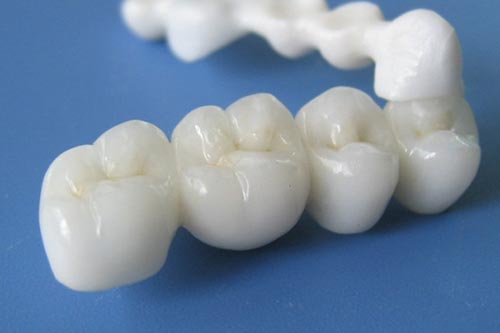 定制式活動(dòng)義齒醫(yī)療器械注冊證變更案例